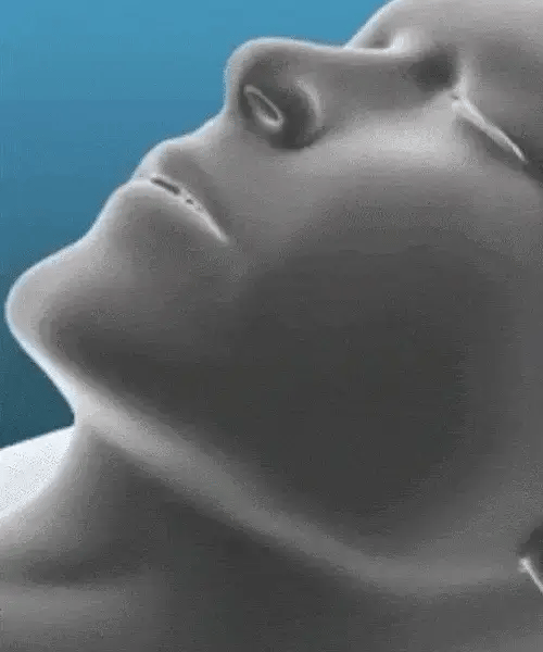 Sonrisa Perfecta Durmiendo