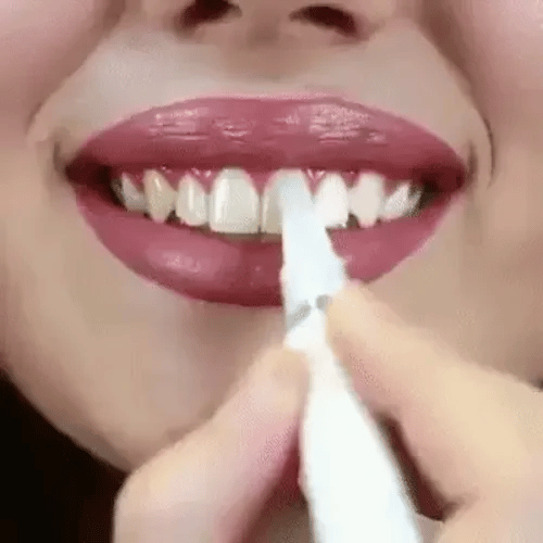 Sonrisa Blanca Rápida