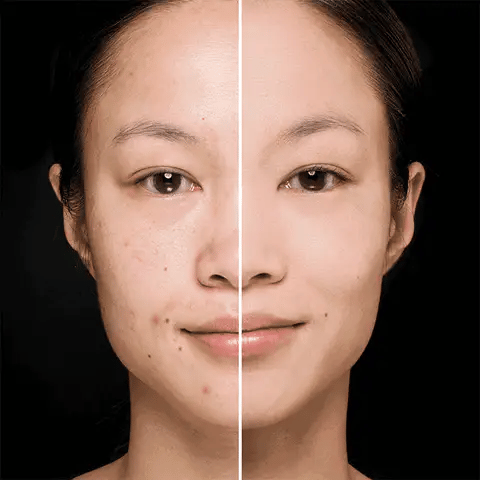 Serum Maravilla para el Rostro